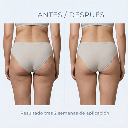 Legging 3D Cellunia – Redefina su silueta sin esfuerzo