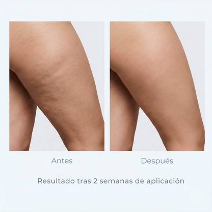 Legging 3D Cellunia – Redefina su silueta sin esfuerzo